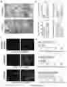 Fig. 02 - NAÏVE HUMAN EMBRYONIC VASCULAR PROGENITOR CELLS AND METHODS OF TREATMENT