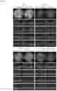 Fig. 07 - COMPOSITIONS AND METHODS FOR PREVENTING OR TREATING MACULAR DEGENERATION