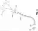 Fig. 04 - Mud applicator