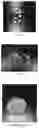 Fig. 07 - AGGREGATE OF CELL CARRIER PARTICLES AND METHOD FOR PREPARING SAME