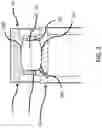 Fig. 02 - Duplex hardened cage pilot surface for bearing ring