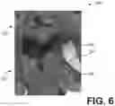 Fig. 06 - Systems and methods for adaptive blending in computed tomography imaging