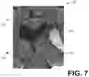 Fig. 07 - Systems and methods for adaptive blending in computed tomography imaging