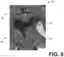 Fig. 08 - Systems and methods for adaptive blending in computed tomography imaging