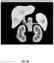 Fig. 07 - Medical imaging based on calibrated post contrast timing