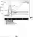 Fig. 09 - Medical imaging based on calibrated post contrast timing