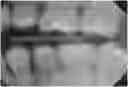 Fig. 01 - Dental imaging system utilizing artificial intelligence