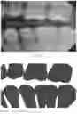 Fig. 06 - Dental imaging system utilizing artificial intelligence