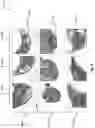 Fig. 08 - Systems and methods for automatic detection and quantification of pathology using dynamic feature classification