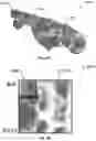 Fig. 09 - Systems and methods for automatic detection and quantification of pathology using dynamic feature classification