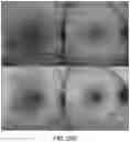 Fig. 35 - Systems and methods for detection of ocular disease