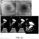 Fig. 41 - Systems and methods for detection of ocular disease
