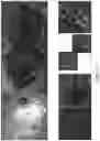 Fig. 49 - Systems and methods for detection of ocular disease