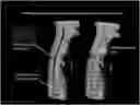 Fig. 01 - Novel, quantitative framework for the diagnostic, prognostic, and therapeutic evaluation of spinal cord diseases