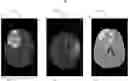 Fig. 01 - Tumor segmentation tool
