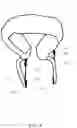 Fig. 05 - Sleep support device
