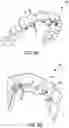 Fig. 09 - Clear plastic aligner protrusions for anterior or open bite treatment and mattress plastic material for invisible aligners
