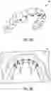 Fig. 10 - Clear plastic aligner protrusions for anterior or open bite treatment and mattress plastic material for invisible aligners