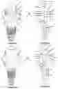Fig. 04 - ASSEMBLY FOR DENTAL RESTORATION