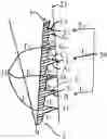 Fig. 01 - Dental implant