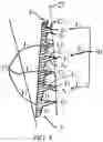 Fig. 03 - Dental implant