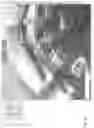Fig. 05 - SNAPPING OF DENTURE TEETH