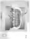 Fig. 06 - SNAPPING OF DENTURE TEETH