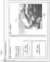 Fig. 09 - SNAPPING OF DENTURE TEETH