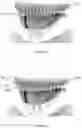 Fig. 20 - Oral applicator device