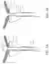 Fig. 04 - UROLOGIC STENTS AND METHODS OF USE