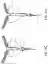 Fig. 05 - UROLOGIC STENTS AND METHODS OF USE