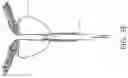 Fig. 06 - UROLOGIC STENTS AND METHODS OF USE