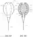 Fig. 10 - UROLOGIC STENTS AND METHODS OF USE