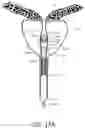 Fig. 18 - UROLOGIC STENTS AND METHODS OF USE