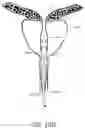 Fig. 21 - UROLOGIC STENTS AND METHODS OF USE