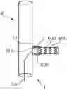 Fig. 01 - Stent-graft prosthesis, system and method for improved delivery of a stent-graft prosthesis