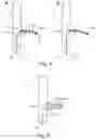 Fig. 04 - Stent-graft prosthesis, system and method for improved delivery of a stent-graft prosthesis