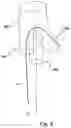 Fig. 07 - Stent-graft prosthesis, system and method for improved delivery of a stent-graft prosthesis