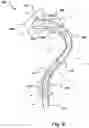 Fig. 08 - Stent-graft prosthesis, system and method for improved delivery of a stent-graft prosthesis