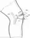 Fig. 01 - TISSUE CAPTURING BONE ANCHOR
