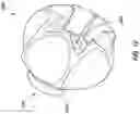 Fig. 18 - TISSUE CAPTURING BONE ANCHOR