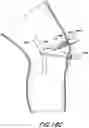 Fig. 30 - TISSUE CAPTURING BONE ANCHOR