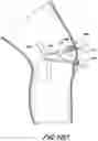 Fig. 31 - TISSUE CAPTURING BONE ANCHOR