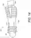 Fig. 24 - SYSTEM AND METHOD FOR SECURING TISSUE TO BONE