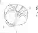 Fig. 31 - SYSTEM AND METHOD FOR SECURING TISSUE TO BONE