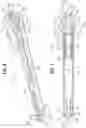 Fig. 05 - Mechanically expandable prosthetic heart valve and delivery apparatus