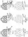 Fig. 03 - Heart valve prosthesis anchored to interventricular septum and conveying and releasing method thereof