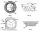 Fig. 06 - Heart valve prosthesis anchored to interventricular septum and conveying and releasing method thereof