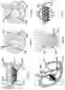 Fig. 08 - Heart valve prosthesis anchored to interventricular septum and conveying and releasing method thereof