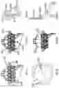 Fig. 11 - Heart valve prosthesis anchored to interventricular septum and conveying and releasing method thereof